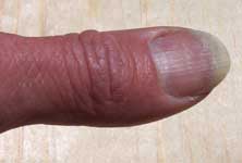 [human thumb]