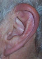 [ear]